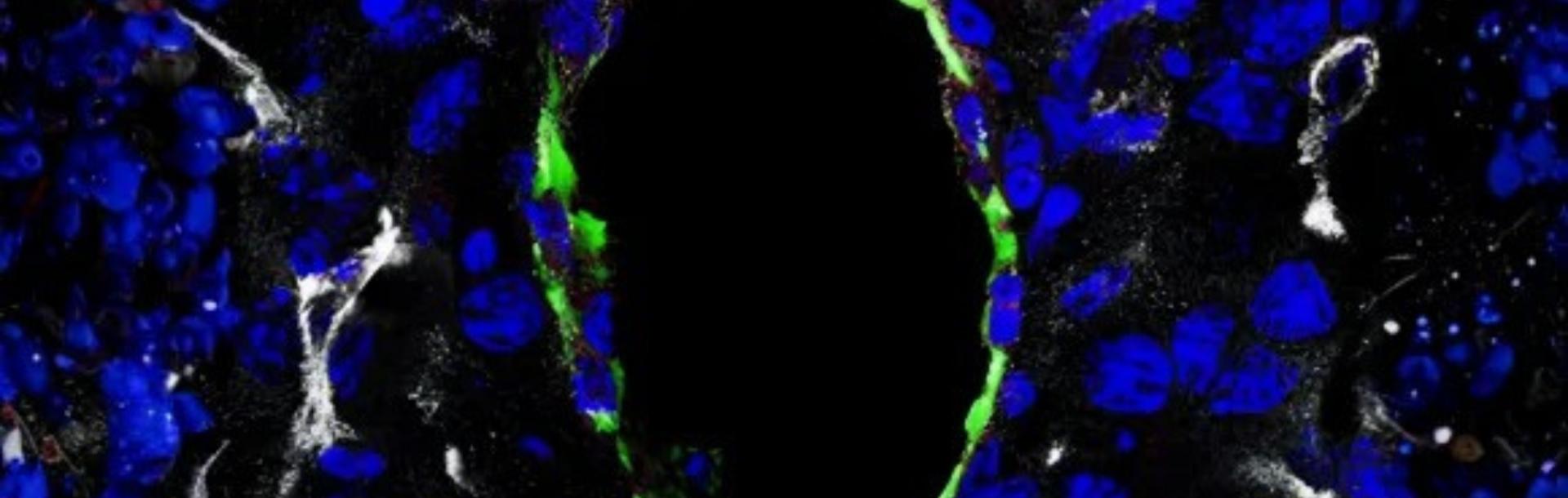 A study by Dr. Merav Cohen and colleagues reveals how macrophages undergo long-lasting functional changes after engulfing dead cancer cells, uncovering a previously unknown mechanism that promotes tumor progression