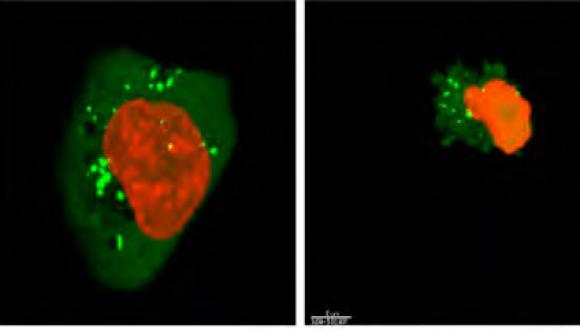 Cancer cell eradication